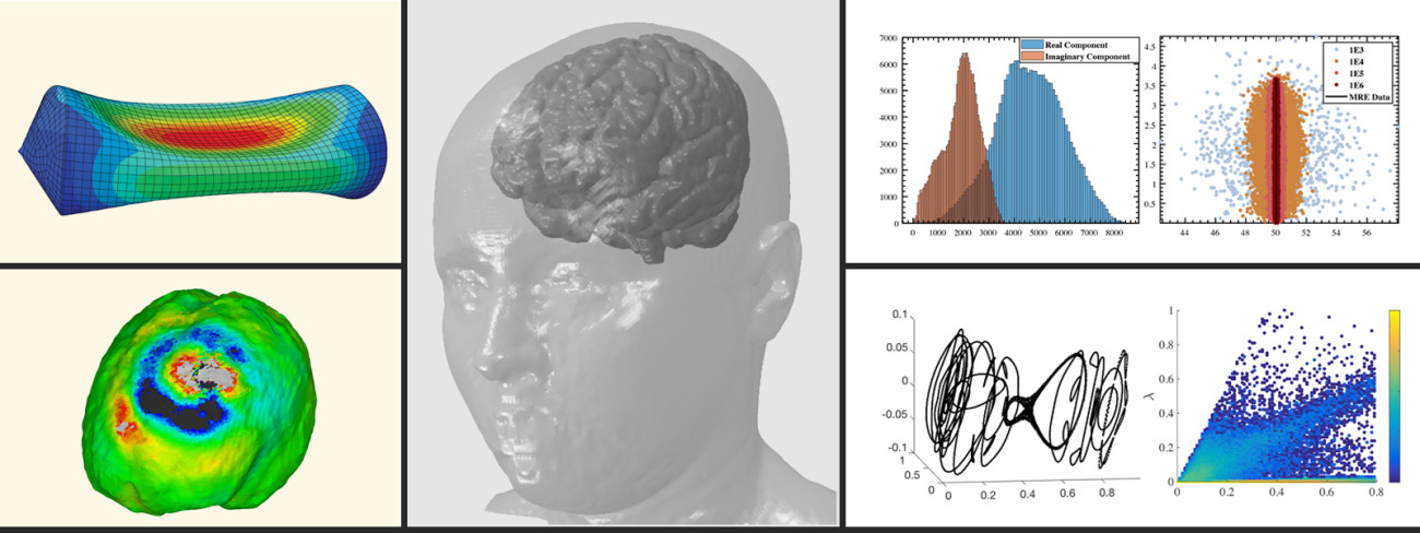 rendering of brain and graphs